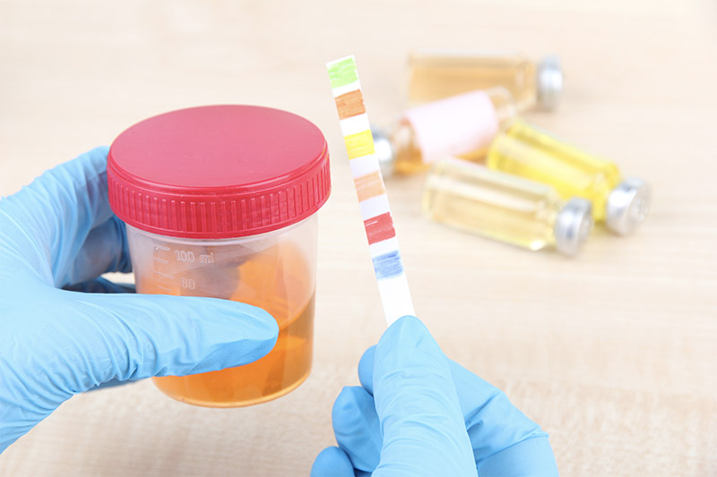 Urine Drug Tests